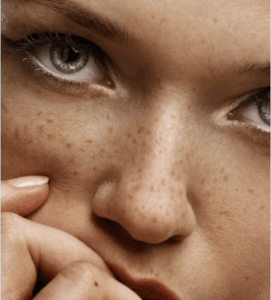 Freckle tattoo 
